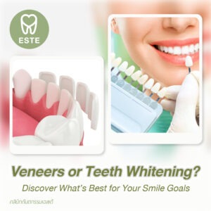 Veneers or Teeth Whitening? Discover Your Perfect Smile Solution!
