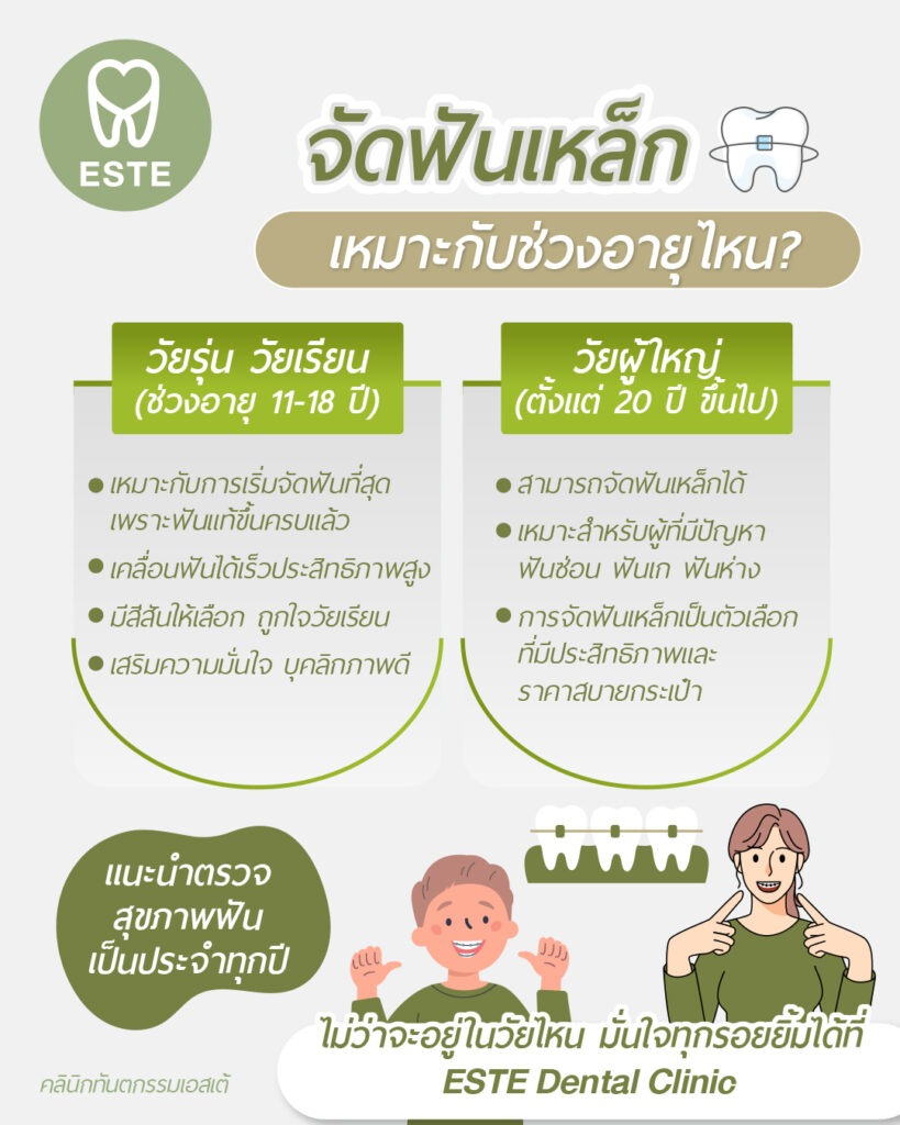 จัดดฟันเหล็ก