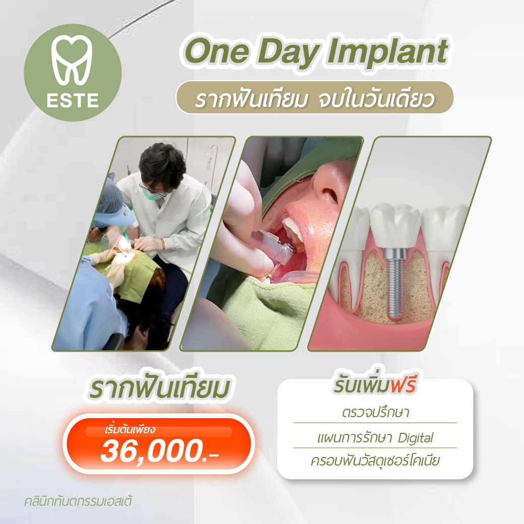 One Day Implant