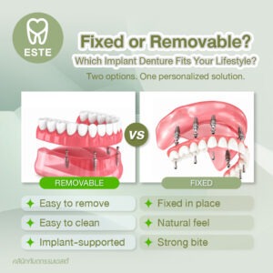 Fixed or Removable? Which Implant Denture Is Right for You?